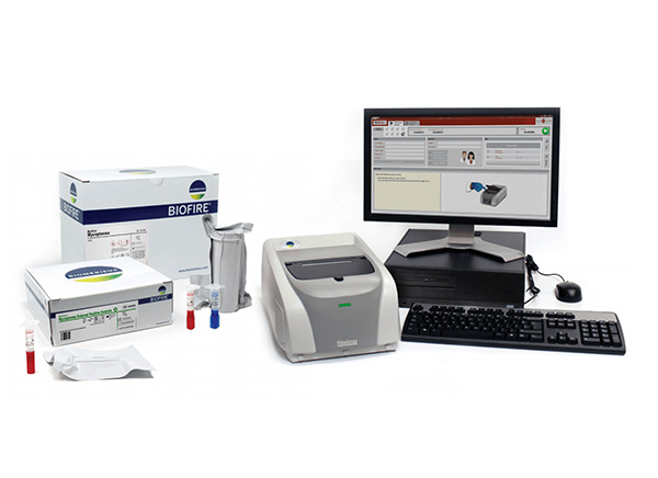 Simple, Accurate, and Rapid In-House Mycoplasma Detection